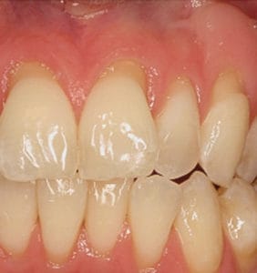 Case Study - Cosmetic Dentistry Before Image