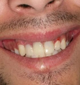 Case Study - Cosmetic Dentistry After Image