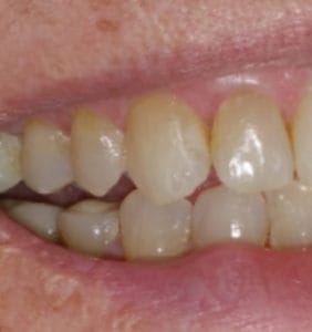 Case Study - Cosmetic Dentistry After Image