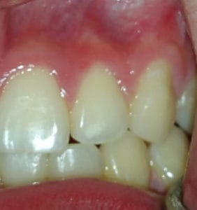 Case Study - Cosmetic Dentistry After Image