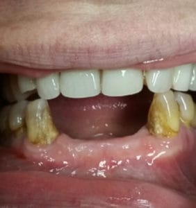 Case Study - Cosmetic Dentistry Before Image