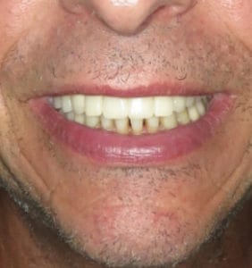 Case Study - Cosmetic Dentistry After Image