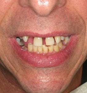 Case Study - Cosmetic Dentistry Before Image