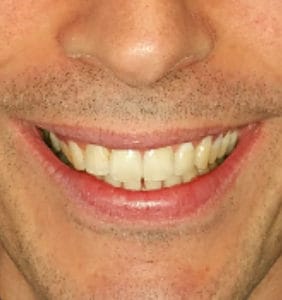 Case Study - Cosmetic Dentistry After Image