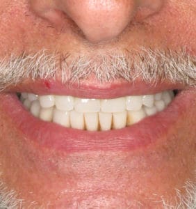 Clocktower Dental | Client Before & After Photos