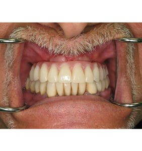 Clocktower Dental | Client Before & After Photos