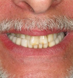 Clocktower Dental | Client Before & After Photos