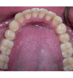 Case Study - Cosmetic Dentistry After Image