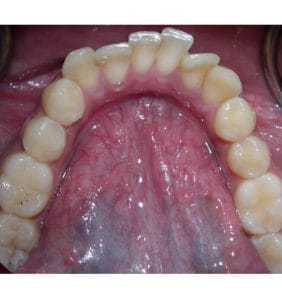 Case Study - Cosmetic Dentistry Before Image