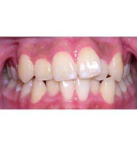 Case Study - Cosmetic Dentistry Before Image