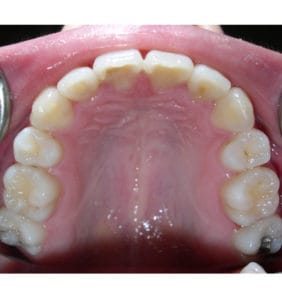 Case Study - Cosmetic Dentistry After Image