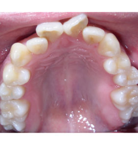 Case Study - Cosmetic Dentistry Before Image