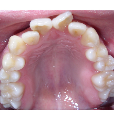 Orthodontics Case 12