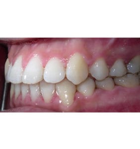 Case Study - Cosmetic Dentistry After Image