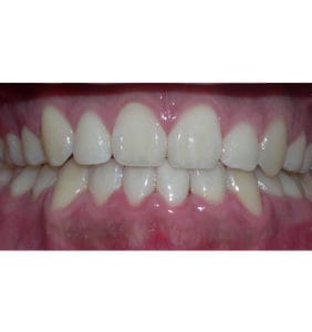 Case Study - Cosmetic Dentistry After Image