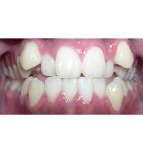 Case Study - Cosmetic Dentistry Before Image