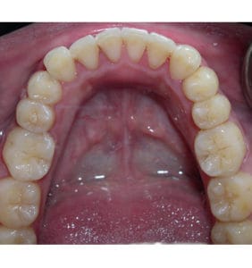 Case Study - Cosmetic Dentistry After Image