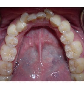 Case Study - Cosmetic Dentistry Before Image