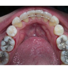 Case Study - Cosmetic Dentistry After Image