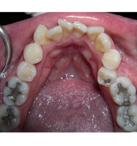 Case Study - Cosmetic Dentistry Before Image