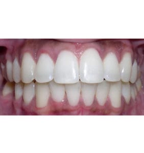 Case Study - Cosmetic Dentistry After Image