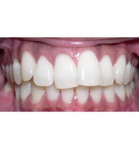 Case Study - Cosmetic Dentistry Before Image