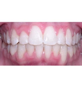 Case Study - Cosmetic Dentistry After Image