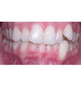 Case Study - Cosmetic Dentistry Before Image
