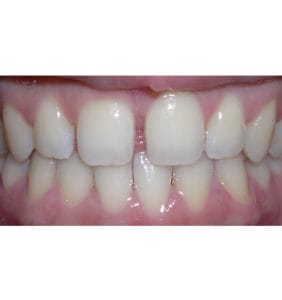 Case Study - Cosmetic Dentistry Before Image