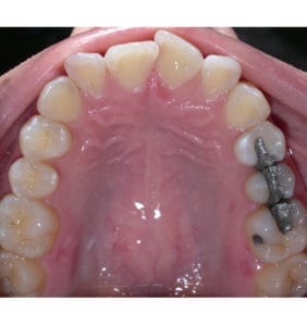 Case Study - Cosmetic Dentistry After Image
