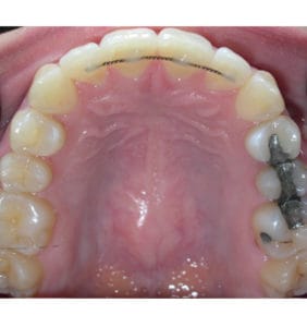 Case Study - Cosmetic Dentistry Before Image