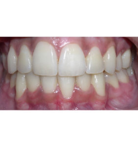 Case Study - Cosmetic Dentistry After Image