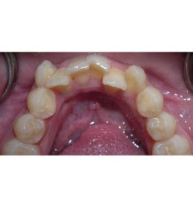 Case Study - Cosmetic Dentistry Before Image