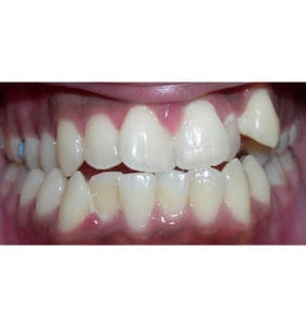 Case Study - Cosmetic Dentistry Before Image