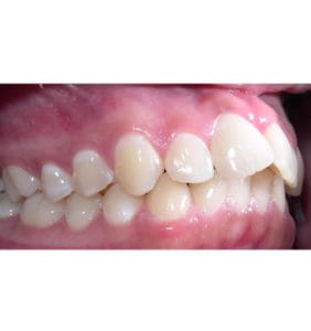 Case Study - Cosmetic Dentistry Before Image