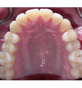 Case Study - Cosmetic Dentistry After Image