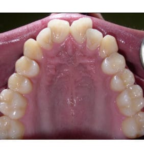 Case Study - Cosmetic Dentistry Before Image