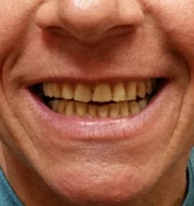 Case Study - Cosmetic Dentistry Before Image