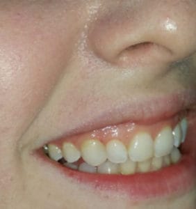 Long Island Specialists in Dental Care | Clock Tower Dental | Franklin Square, NY