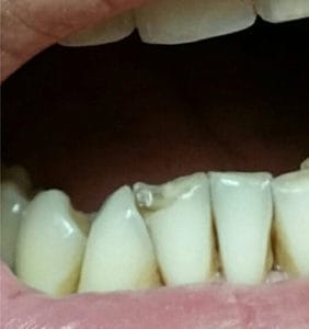 Long Island Specialists in Dental Care | Clock Tower Dental | Franklin Square, NY