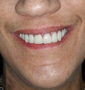 Long Island Specialists in Dental Care | Clock Tower Dental | Franklin Square, NY