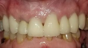 Long Island Specialists in Dental Care | Clock Tower Dental | Franklin Square, NY