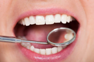 Photo of Dental Inspection