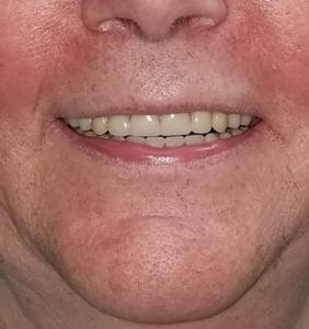 Long Island Specialists in Dental Care | Clock Tower Dental | Franklin Square, NY