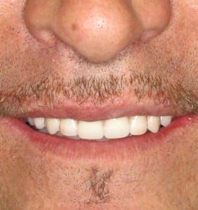 Long Island Specialists in Dental Care | Clock Tower Dental of Franklin Square