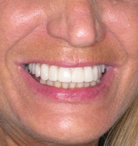 Clocktower Dental | Client Before & After Photos