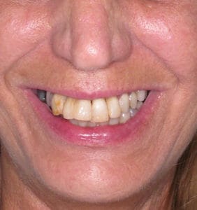 Clocktower Dental | Client Before & After Photos