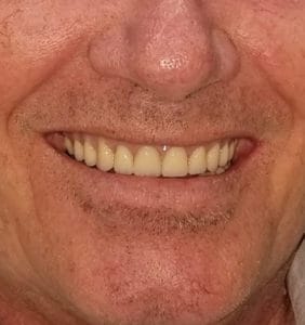 Clocktower Dental | Client Before & After Photos