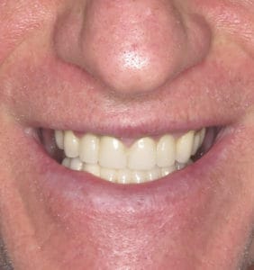 Clocktower Dental | Client Before & After Photos