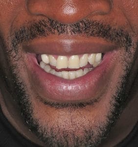 Clocktower Dental | Client Before & After Photos
